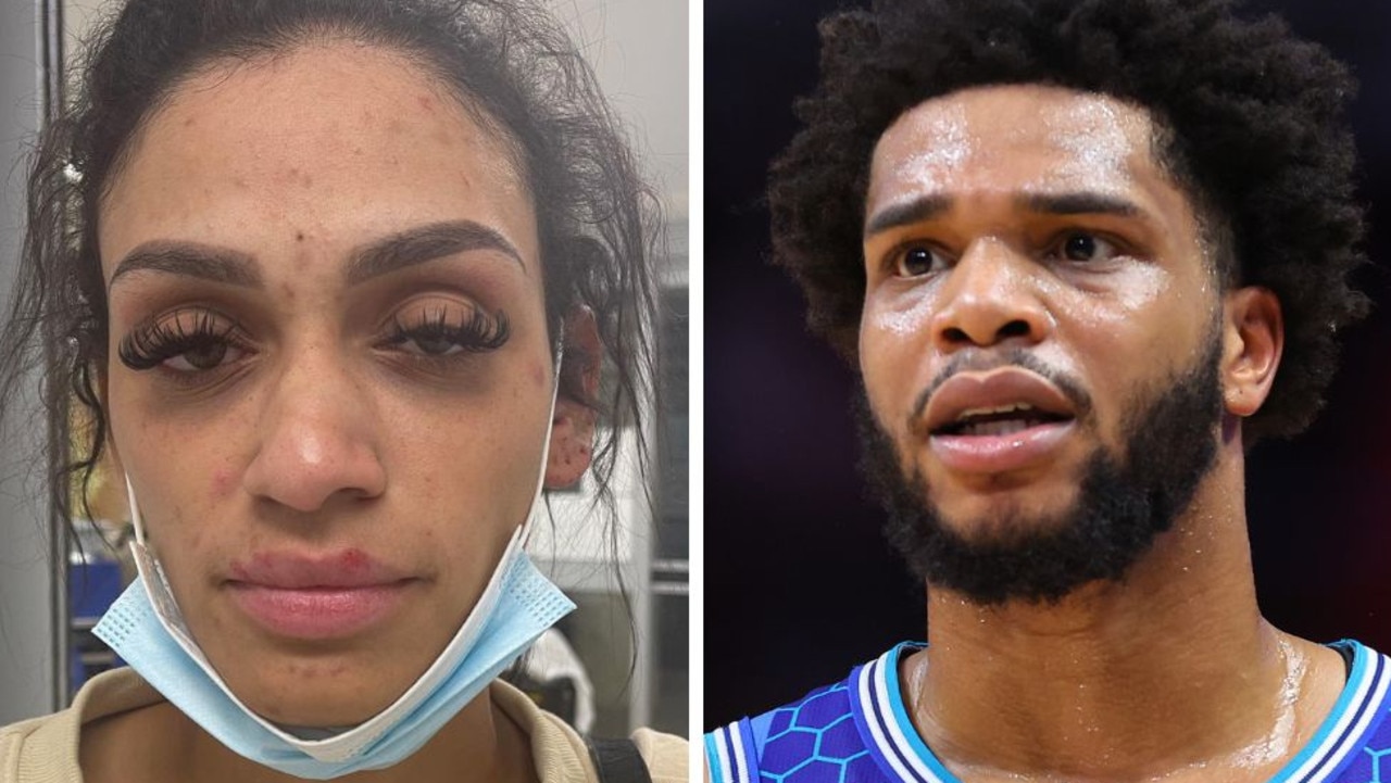 Nouvelles de la NBA: la femme de Miles Bridges partage des photos de violence domestique présumée, Mychelle Johnson, Charlotte Hornets