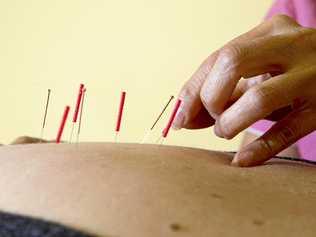 Daphne Fung . Esoteric Acupuncture. Photo Nev Madsen / The Chronicle. Picture: Nev Madsen