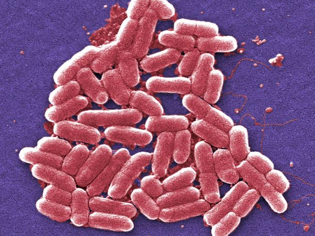 The E. coli bacteria. Picture: AP