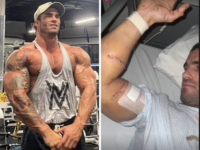 Bodybuilder breaks silence after coma