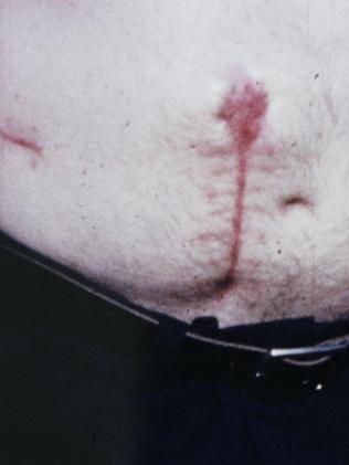 Mr Griffiths was badly injured by shrapnel in the 1978 bombing.