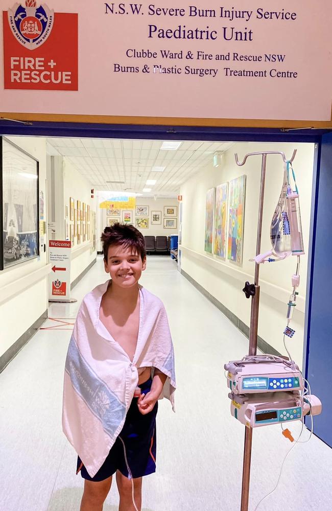 Elias Carrera, 11, recovering in hospital after surgery for injuries caused by a firework hitting his chest at a Christmas carols event. Picture: Carrera family