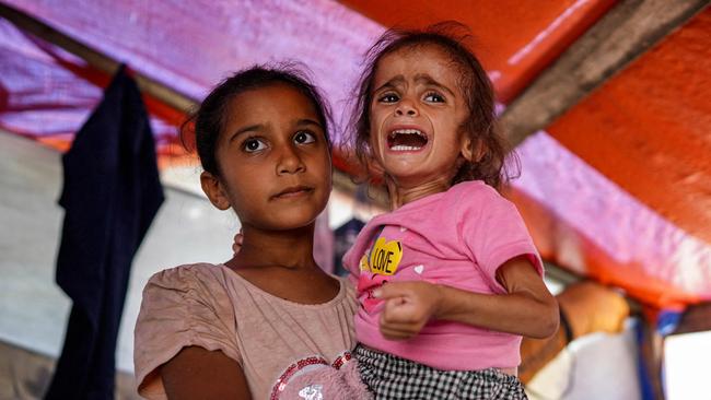 Hana Abdelrahaman al-Rai, a four-year-old child suffering from severe malnutrition and displaced from Gaza City's eastern suburb of Shujaiya. Picture: AFP