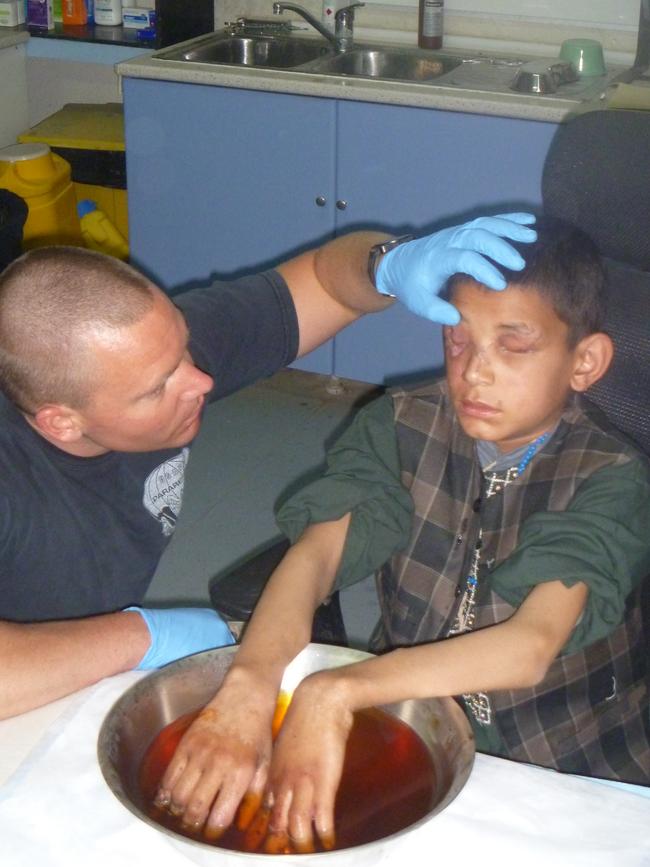 Major Dan Pronk inspects a boy’s blinded eyes as he treats his hands. Picture: Supplied