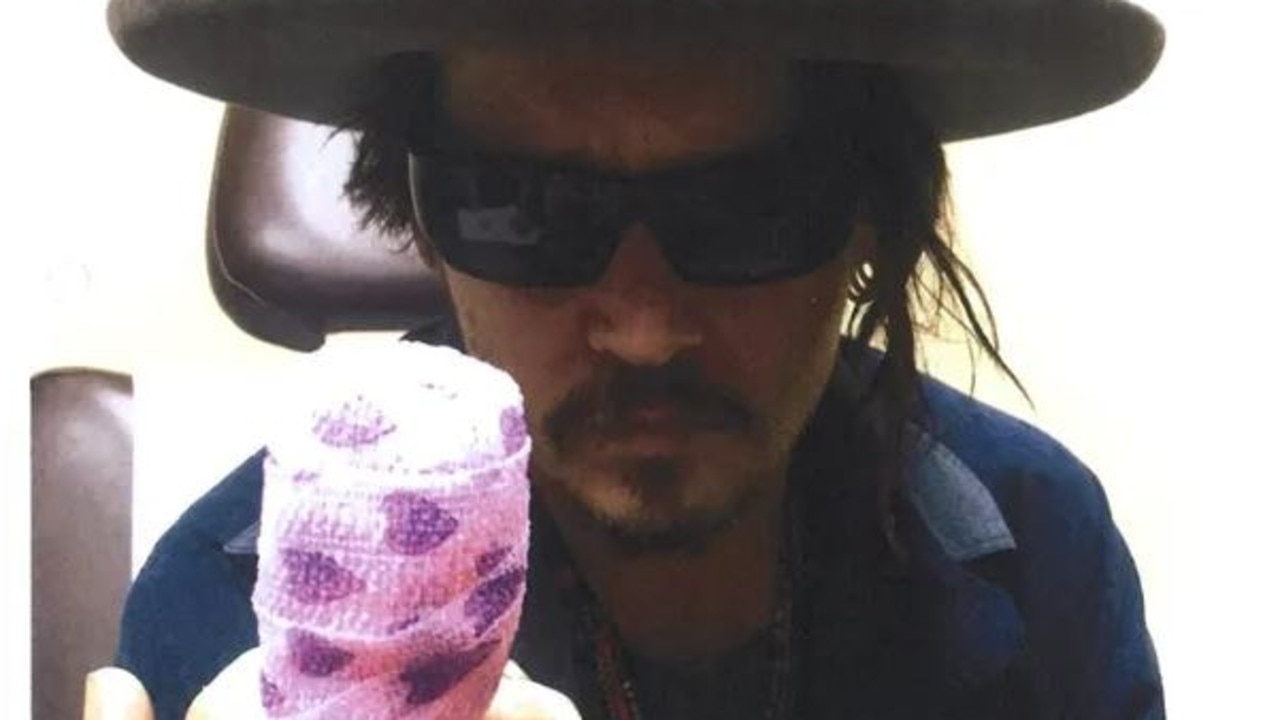 Johnny Depp and his injured finger.