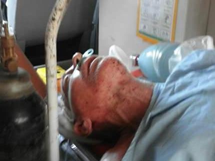 Injured Aussie John Burke needs life saving medical treatment. Picture: Komang Erviani