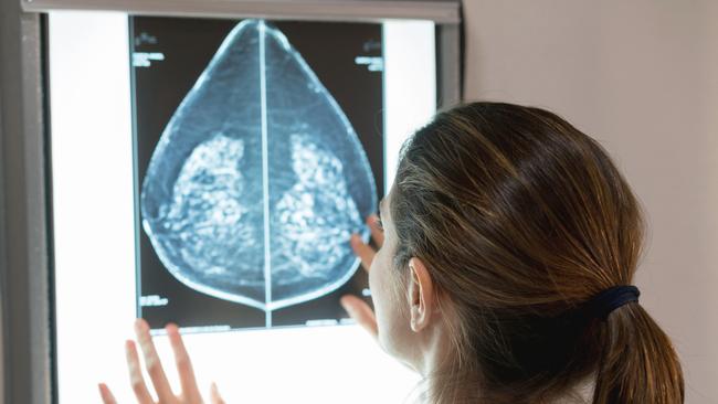 Unrecognizable female gynocologist looking at a patients mammogram at the hospital