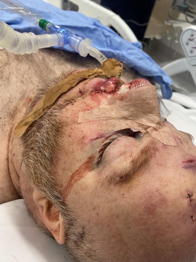 He is still recovering in the RAH after the crash on Mother’s Day. Picture: Supplied