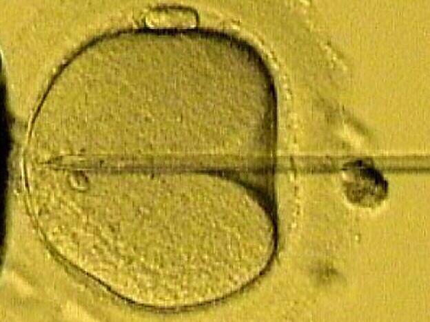 An image of a needle containing a sperm being injected into a female egg. pic/supplied/IVF/South. / Medical childbirth science embryos