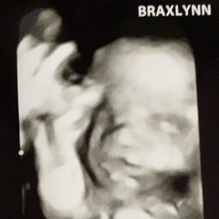 Tragically, baby Braxlynn later died. Picture: Facebook/Reagan Hancock