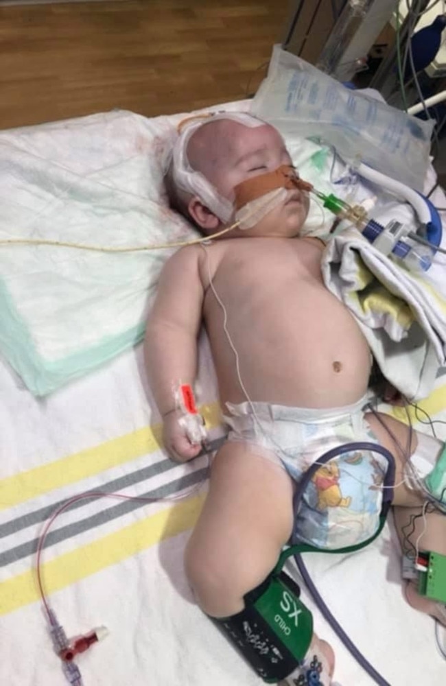 Coen Wylie had brain surgery at just six months of age. Picture: Supplied