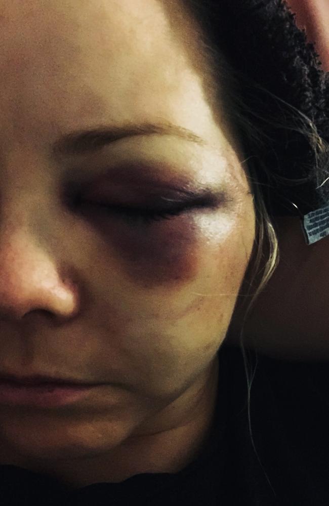 Ms O’Reilly suffered an hour-long assault at the hands of country footy player Jake Frecker in 2019. Picture: Supplied