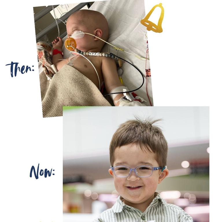 Luca has been left legally blind and with hearing loss but has come a long way since that first photo. Picture: Perth Children’s Hospital