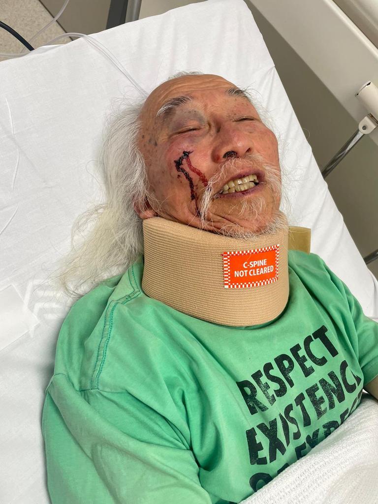 Mr Lim is now in hospital after the incident with injuries to his head. Picture: Chris Murphy