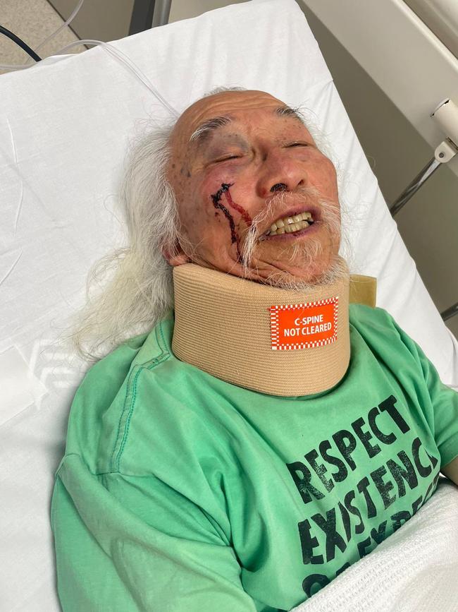 Mr Lim in hospital with injuries to his head. Picture: Chris Murphy