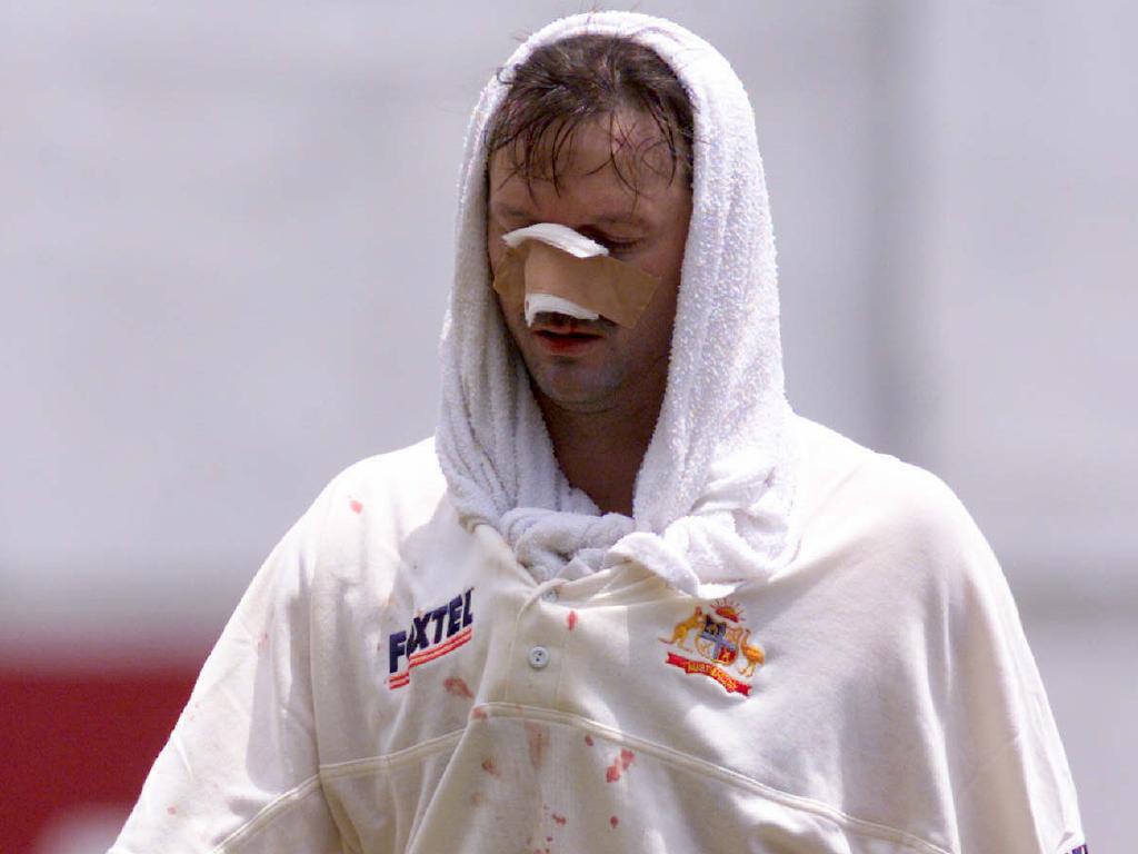 The captain’s face wasn’t a pretty sight after colliding with Jason Gillespie.