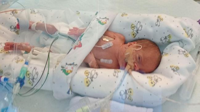 Lyla Jane Cassady is the youngest surviving baby ever born at Innisfail Hospital. Picture: Supplied