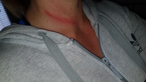 A woman was injured by fishing line strung up at neck height across at street at Christie Downs in July 2019.