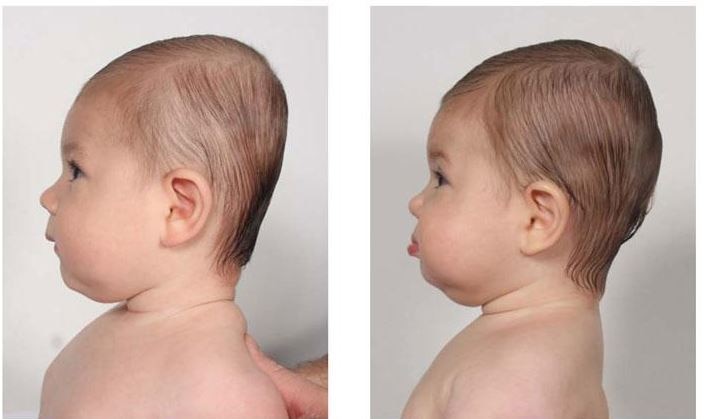 Tips to avoid flat head best sale in babies