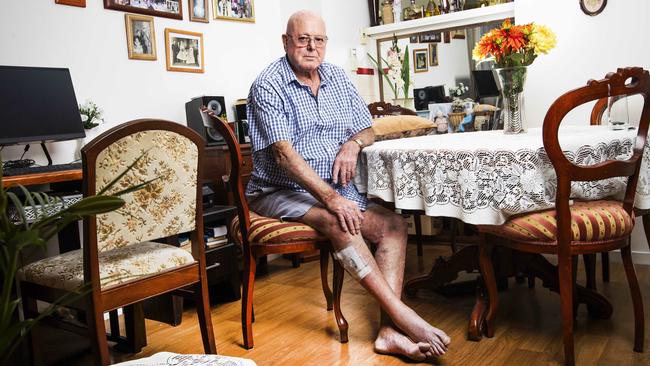 Allan Strip, 79, waited two hours for an ambulance to pick him up, and then spent another hour on the ambulance ramp. Picture: Nigel Hallett