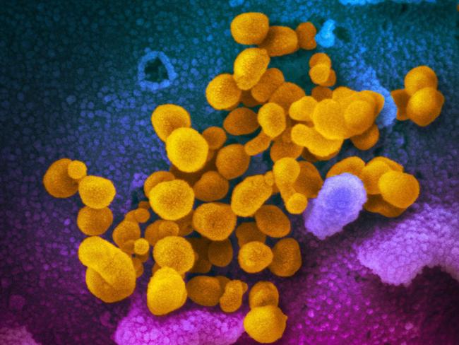 This handout illustration image obtained February 27, 2020 courtesy of the National Institutes of Health taken with a scanning electron microscope  shows SARS-CoV-2 (yellow)—also known as 2019-nCoV, the virus that causes COVID-19—isolated from a patient in the US, emerging from the surface of cells (blue/pink) cultured in the lab. - President Donald Trump has played down fears of a major coronavirus outbreak in the United States, even as infections ricochet around the world, prompting a ban on pilgrims to Saudi Arabia. China is no longer the only breeding ground for the deadly virus as countries fret over possible contagion coming from other hotbeds of infection, including Iran, South Korea and Italy. There are now more daily cases being recorded outside China than inside the country, where the virus first emerged in December, according to the World Health Organization. (Photo by Handout / National Institutes of Health / AFP) / RESTRICTED TO EDITORIAL USE - MANDATORY CREDIT "AFP PHOTO /NATIONAL INSTITUTES OF HEALTH/NIAID-RML/HANDOUT " - NO MARKETING - NO ADVERTISING CAMPAIGNS - DISTRIBUTED AS A SERVICE TO CLIENTS