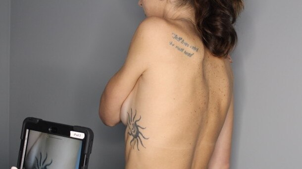 Former Olympian Anna Flanagan is getting her tattoos removed.