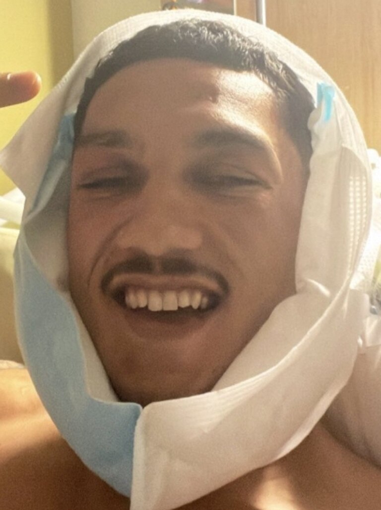 Jai Opetaia could still afford a smile after breaking his jaw.