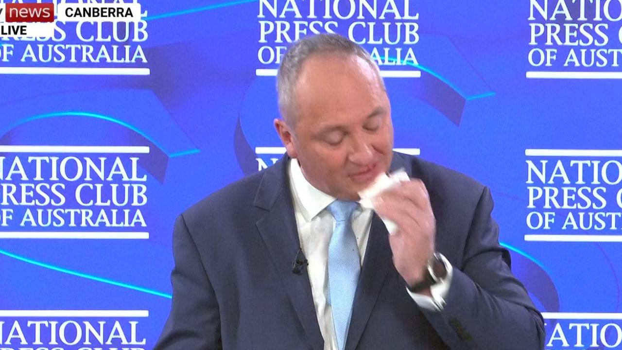 Barnaby Joyce wipes his bloody nose.