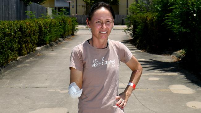 Garbutt resident Annmarie Walters lost her arm in a dog attack. Picture: Evan Morgan