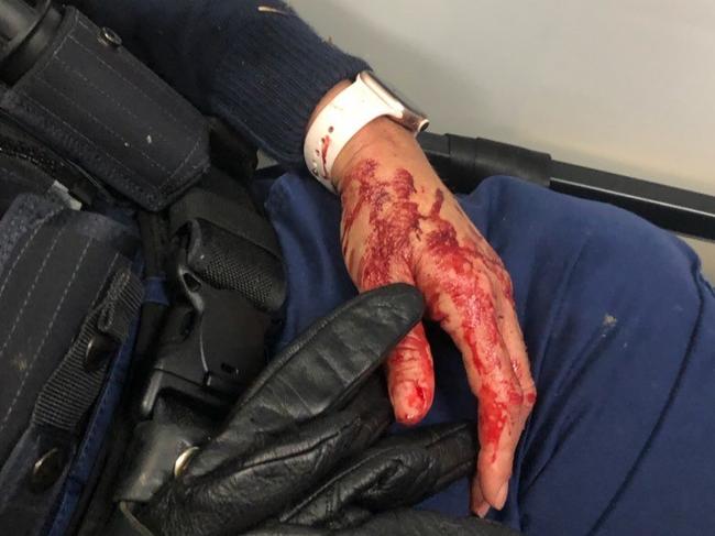 The officer was left covered in blood after the alleged assault. Picture: NSW Police.