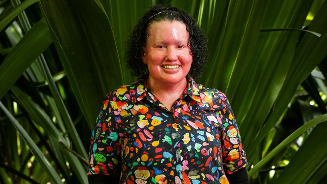 Melbourne disability advocate Carly Findlay. Picture: Nicole Cleary