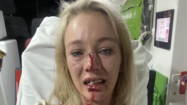 Darwin-based jockey Sonja Logan was bashed by a group of men as she sat in her car outside her home last year.