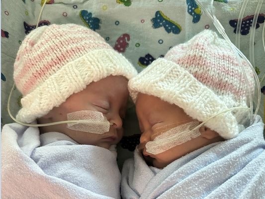 Christmas miracle: Identical twins survive 125-day hospital fight