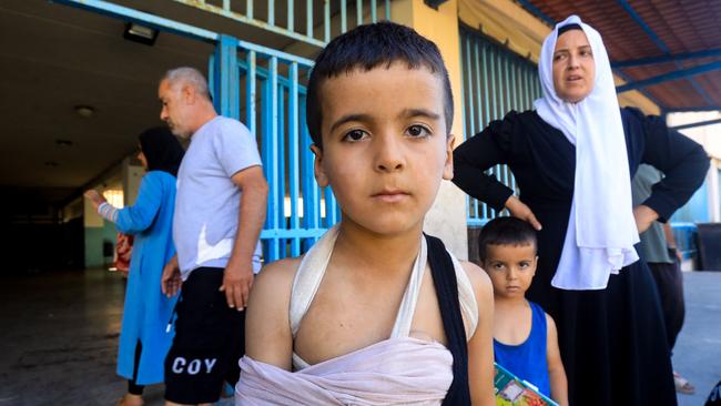 An injured child poses for a picture at a school in Beirut housing. Picture: AFP