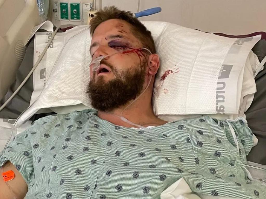 Three people, including the groom (above), were seriously injured after the golf buggy they were travelling in was allegedly hit by a drunk driver. Picture: GoFundMe