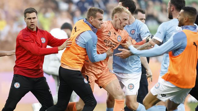 A bleeding Tom Glover is escorted from the pitch by teammates after fans stormed the field at AAMI Park. Picture: Darrian Traynor/Getty Images