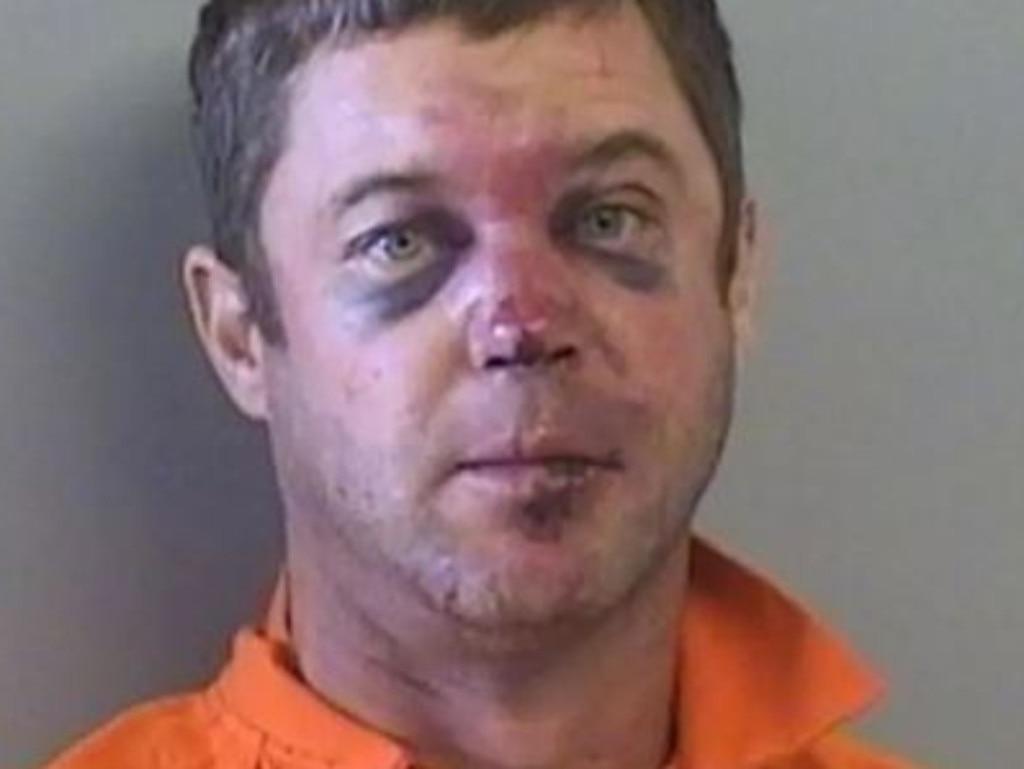 Elliott Binney was arrested on Friday and appeared with two black eyes and other facial bruises in his mugshot. Picture: Tulsa County Jail.