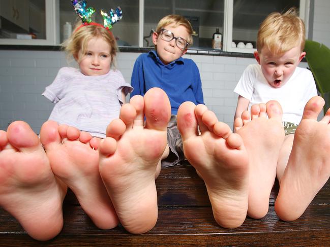 Luisa, Martin and Anderson and their sore feet. A Bell Post Hill family (Tom Higgs and four year old and six year old kids) have walked away from the ARC leisure Centre in Norlane two days in a row with bleeding feet due to the surface in the children's pool. Picture: Alan Barber