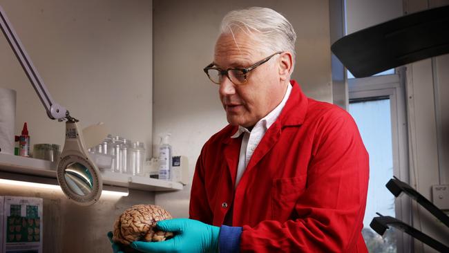 Michael Buckland with a human brain at the Australian Sports Brain Bank. Picture: John Feder