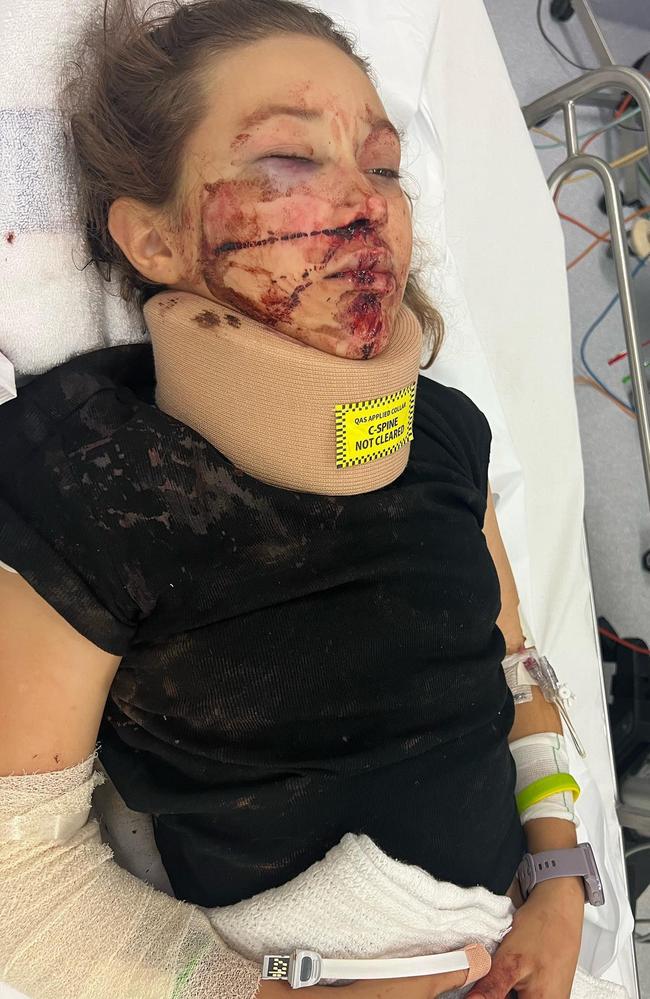 Boondall girl Cheyanne fell several metres while walking on a Mt Ngungun track on October 29. Picture: Facebook