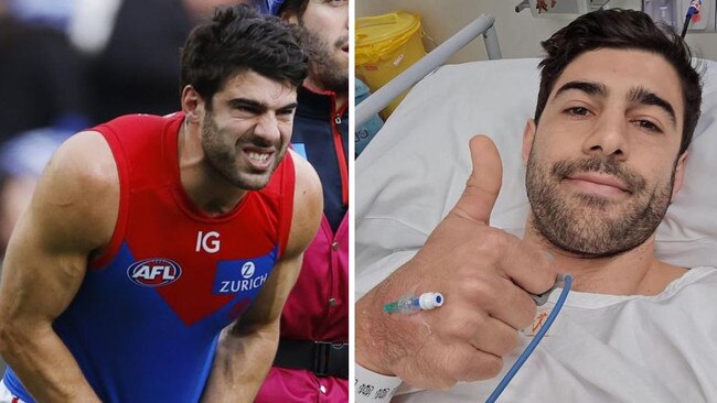Christian Petracca some horrific injuries.