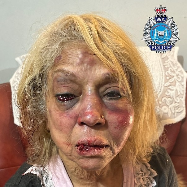 Perth grandmother Nannette was beaten by three cowardly men pretending to be police.