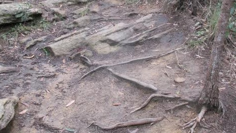 Alleged damage to tree root systems at Westleigh Park. Picture: Supplied