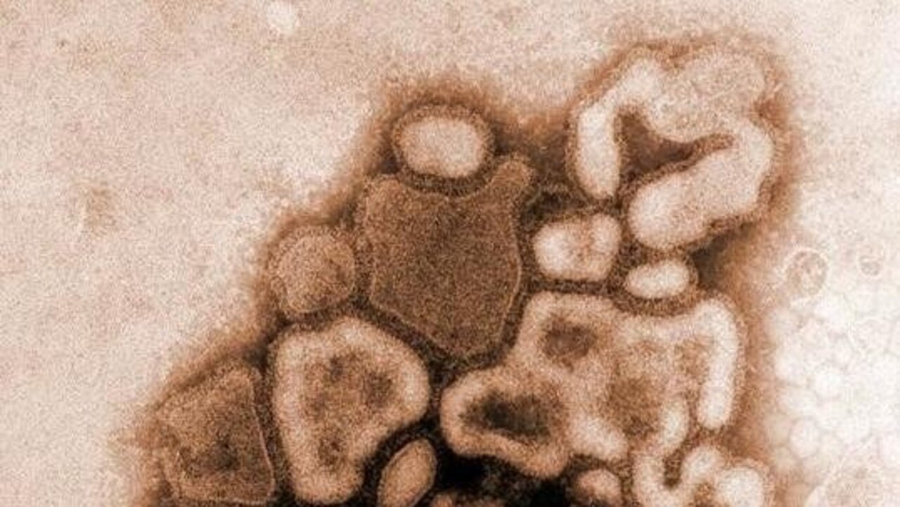 Flu season ‘not over’ as spike in cases rise