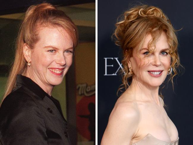 Nicole Kidman at the Verona in 1996 and now.