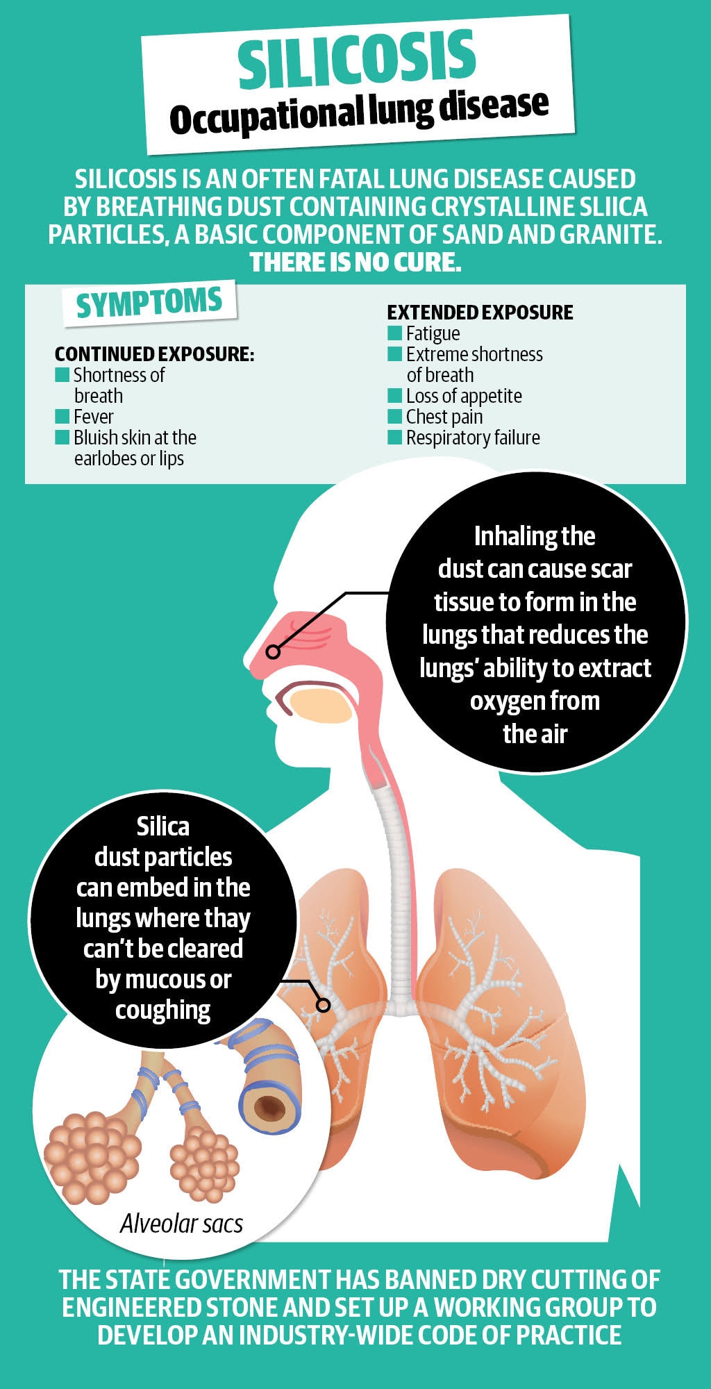 Slater and Gordon launch class action after hundreds contract silicosis ...