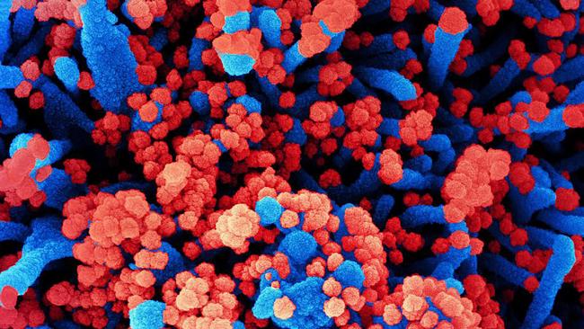 Scientists are on alert after a new variant was detected in France. Picture: National Institute of Allergy and Infectious Diseases/AFP