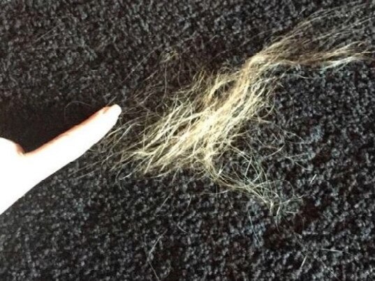 Amber Heard’s hair was said to have been pulled out. Picture: Supplied