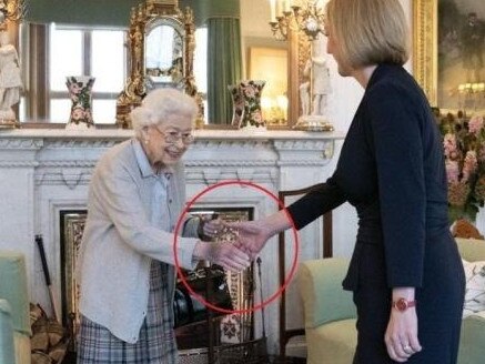 Fears over the Queen's health have been sparked by her hands.