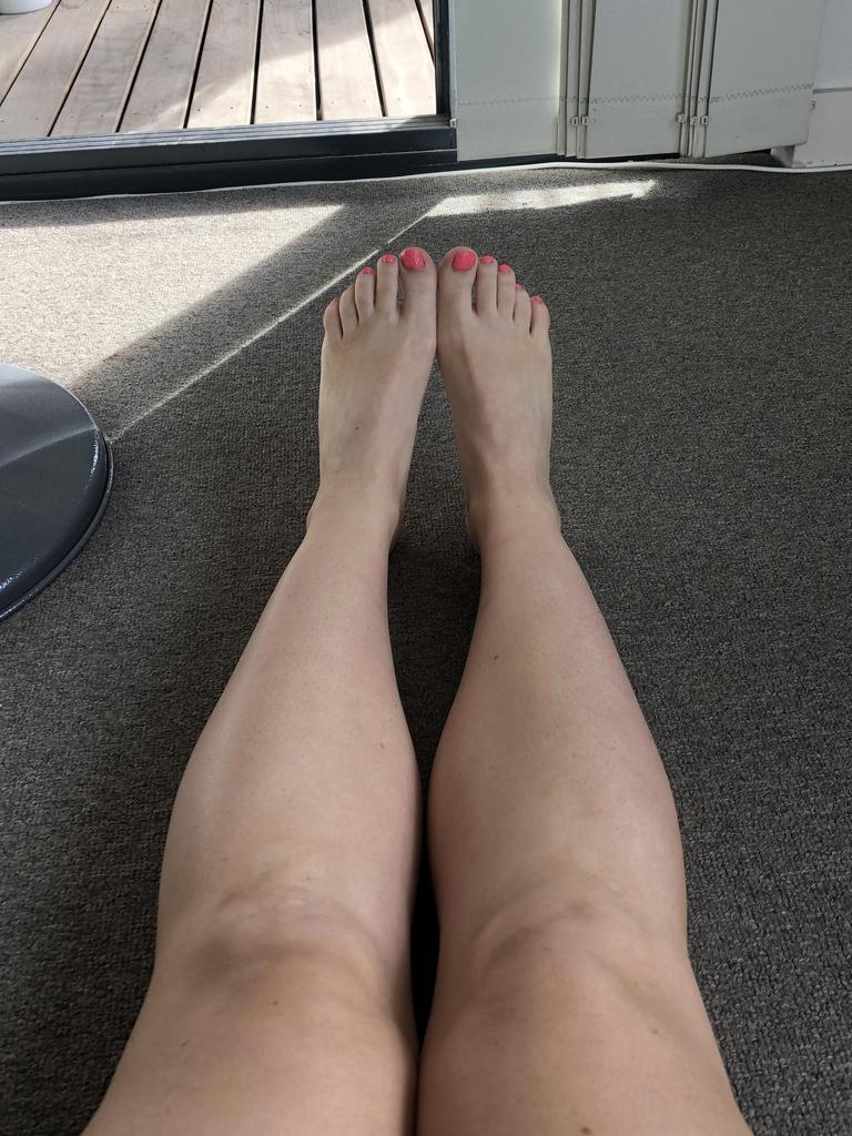 My legs before application. Picture: Supplied